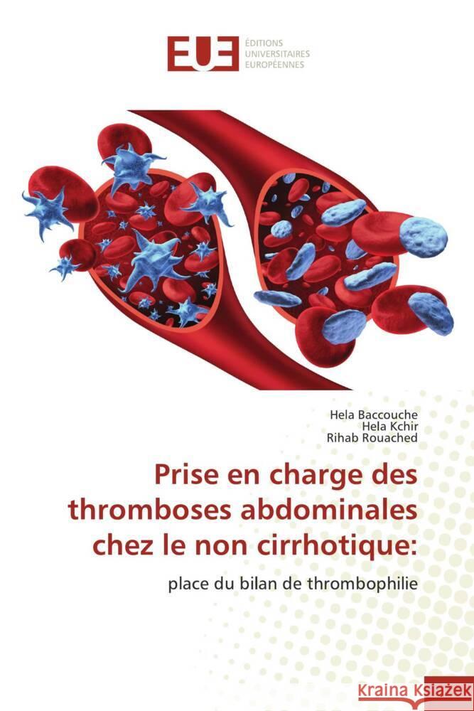 Prise en charge des thromboses abdominales chez le non cirrhotique: Baccouche, Hela, Kchir, Héla, Rouached, Rihab 9786138498711 Éditions universitaires européennes - książka