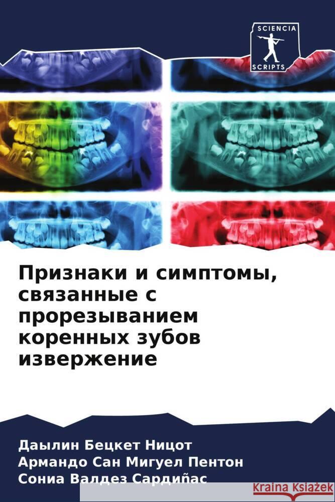 Priznaki i simptomy, swqzannye s prorezywaniem korennyh zubow izwerzhenie Becket Nicot, Daylin, Penton, Armando San Miguel, Valdez Sardiñas, Sonia 9786204551548 Sciencia Scripts - książka