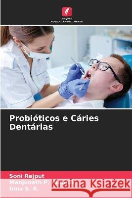 Probióticos e Cáries Dentárias Soni Rajput, Manjunath P Puranik, Uma S R 9786205278765 Edicoes Nosso Conhecimento - książka