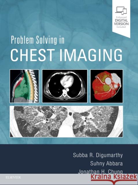 Problem Solving in Chest Imaging Subba R. Digumarthy Suhny Abbara Jonathan H. Chung 9780323041324 Elsevier - Health Sciences Division - książka
