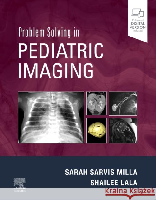 Problem Solving in Pediatric Imaging Shailee (Associate Professor, Department of Radiology, New York University Grossman School of Medicine, New York, New Yo 9781437726121 Elsevier - Health Sciences Division - książka