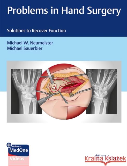 Problems in Hand Surgery: Solutions to Recover Function Neumeister, Michael W. 9781626237094 Thieme Medical Publishers - książka