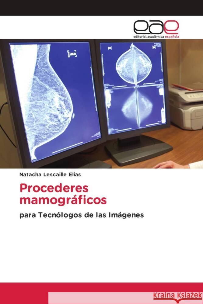 Procederes mamográficos Lescaille Elias, Natacha 9783841756060 Editorial Académica Española - książka