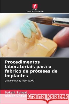 Procedimentos laboratoriais para o fabrico de proteses de implantes Sakshi Sehgal Ashish Choudhary  9786205932582 Edicoes Nosso Conhecimento - książka