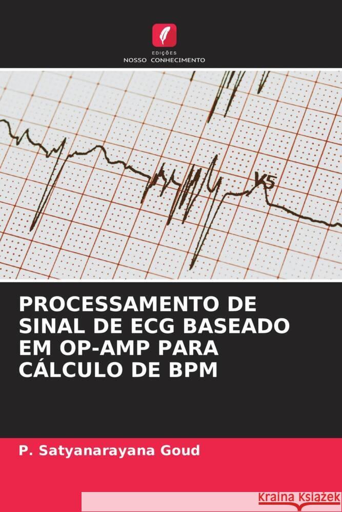 Processamento de Sinal de ECG Baseado Em Op-Amp Para C?lculo de BPM P. Satyanarayana Goud 9786206437918 Edicoes Nosso Conhecimento - książka