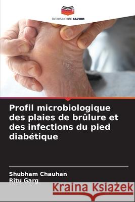 Profil microbiologique des plaies de brûlure et des infections du pied diabétique Shubham Chauhan, Ritu Garg 9786204105253 Editions Notre Savoir - książka