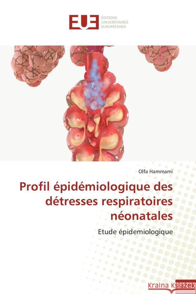 Profil épidémiologique des détresses respiratoires néonatales Hammami, Olfa 9786206690542 Éditions universitaires européennes - książka