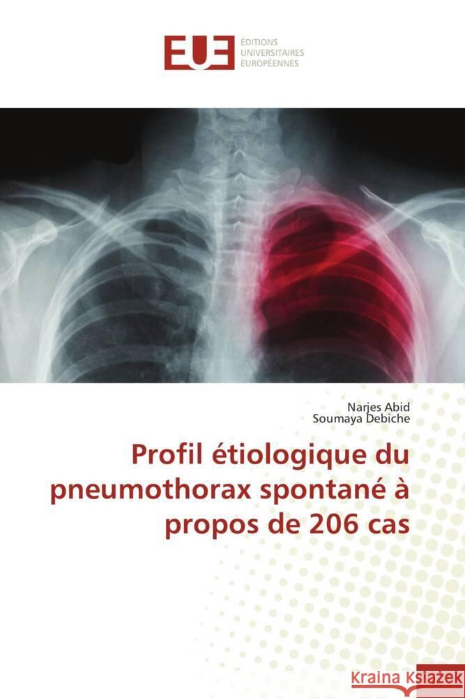 Profil ?tiologique du pneumothorax spontan? ? propos de 206 cas Narjes Abid Soumaya Debiche 9786206723165 Editions Universitaires Europeennes - książka