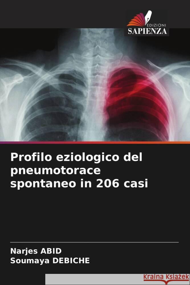 Profilo eziologico del pneumotorace spontaneo in 206 casi Abid, Narjes, Debiche, Soumaya 9786208382520 Edizioni Sapienza - książka