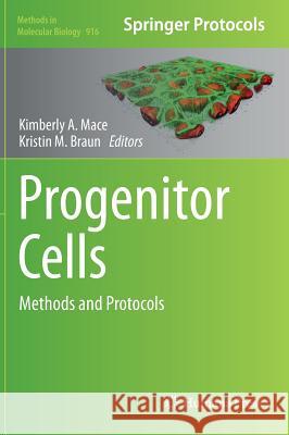 Progenitor Cells: Methods and Protocols Mace, Kimberly A. 9781617799792 Humana Press - książka