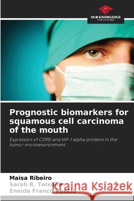 Prognostic biomarkers for squamous cell carcinoma of the mouth Ribeiro, Maisa, R. Teixeira, Sarah, Franco Vêncio, Eneida 9786208774790 Our Knowledge Publishing - książka