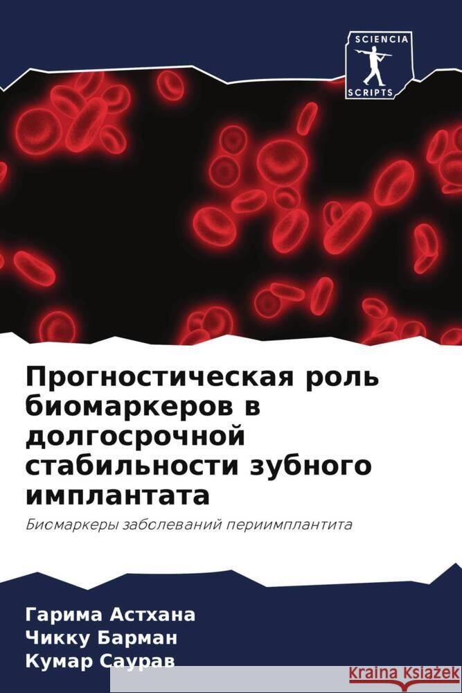 Prognosticheskaq rol' biomarkerow w dolgosrochnoj stabil'nosti zubnogo implantata Asthana, Garima, Barman, Chikku, Sauraw, Kumar 9786205189900 Sciencia Scripts - książka