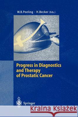 Progress in Diagnostics and Therapy of Prostatic Cancer Peeling                                  W. B. Peeling Hermann Becker 9783540601951 Springer - książka