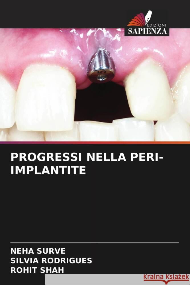 PROGRESSI NELLA PERI-IMPLANTITE SURVE, NEHA, Rodrigues, Silvia, Shah, Rohit 9786207096237 Edizioni Sapienza - książka