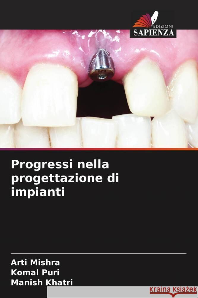 Progressi nella progettazione di impianti Mishra, Arti, Puri, Komal, Khatri, Manish 9786204709437 Edizioni Sapienza - książka