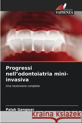 Progressi nell'odontoiatria mini-invasiva Gangwar, Palak 9786202376525 Edizioni Sapienza - książka