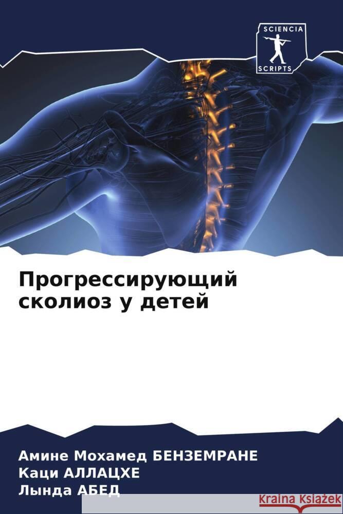 Progressiruüschij skolioz u detej BENZEMRANE, Amine Mohamed, Allache, Kaci, Abed, Lynda 9786205127438 Sciencia Scripts - książka