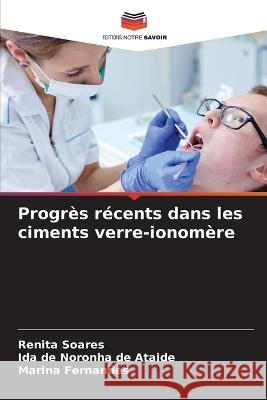 Progrès récents dans les ciments verre-ionomère Soares, Renita 9786205302163 Editions Notre Savoir - książka