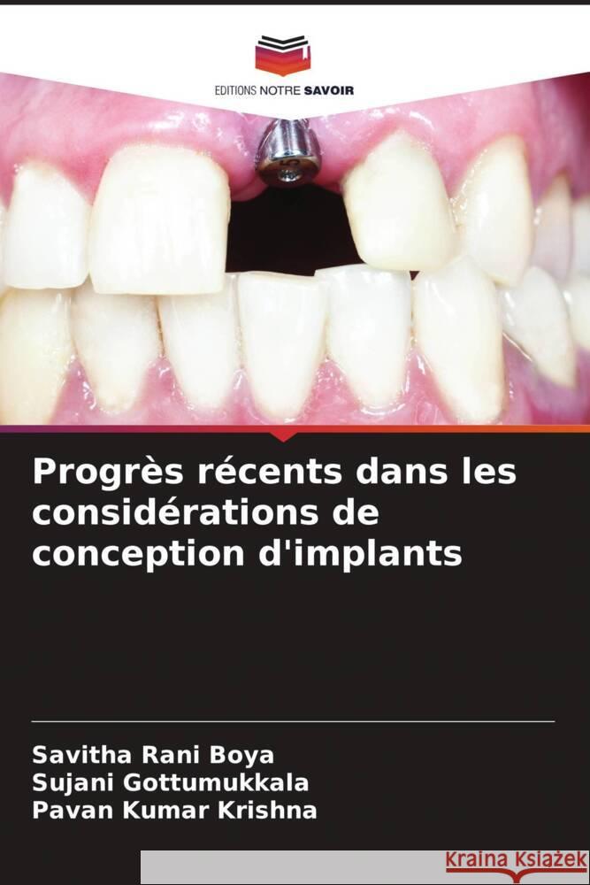 Progrès récents dans les considérations de conception d'implants Boya, Savitha Rani, Gottumukkala, Sujani, Krishna, Pavan Kumar 9786204409962 Editions Notre Savoir - książka