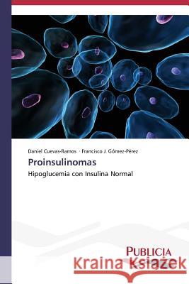 Proinsulinomas Cuevas-Ramos Daniel                      Gomez-Perez Francisco J. 9783639552058 Publicia - książka