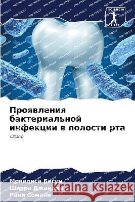 Proqwleniq bakterial'noj infekcii w polosti rta Begum, Monalisa, Dzhaidka, Shipra, Somani, Rani 9786205888643 Sciencia Scripts - książka