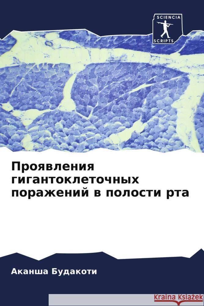 Proqwleniq gigantokletochnyh porazhenij w polosti rta Budakoti, Akansha 9786205059845 Sciencia Scripts - książka