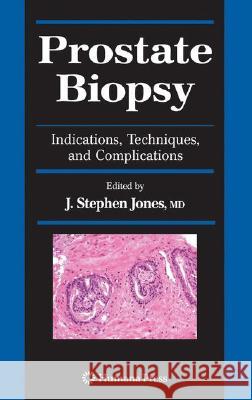 Prostate Biopsy: Indications, Techniques, and Complications Jones, J. Stephen 9781588297907 Humana Press - książka