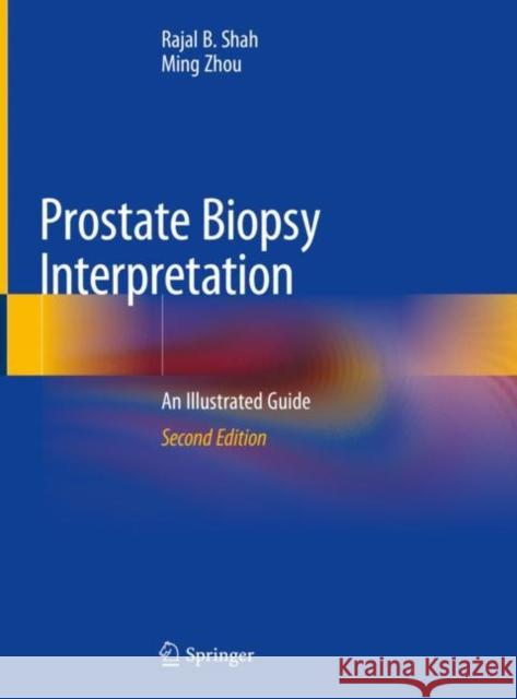 Prostate Biopsy Interpretation: An Illustrated Guide Shah, Rajal B. 9783030136000 Springer - książka