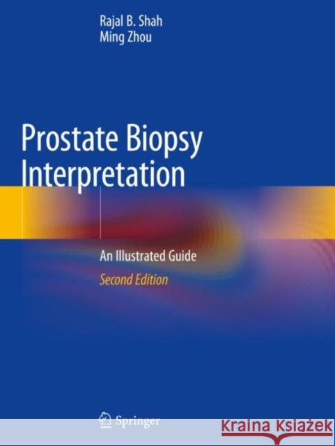 Prostate Biopsy Interpretation: An Illustrated Guide Shah, Rajal B. 9783030136031 Springer International Publishing - książka