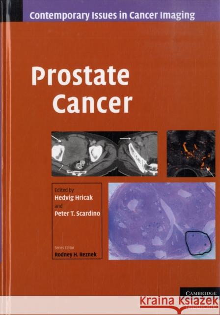 Prostate Cancer Hedvig Hricak 9780521887045  - książka