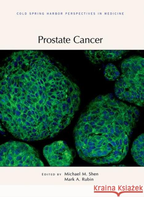Prostate Cancer Michael Shen Mark Rubin 9781621821649 Cold Spring Harbor Laboratory Press,U.S. - książka