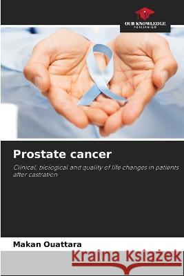 Prostate cancer Makan Ouattara 9786205390832 Our Knowledge Publishing - książka