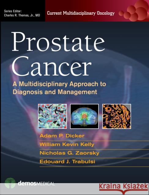 Prostate Cancer: A Multidisciplinary Approach to Diagnosis and Management Adam P. Dicker 9781936287598 Demos Medical Publishing - książka