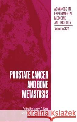 Prostate Cancer and Bone Metastasis  9780306443145 Kluwer Academic / Plenum Publishers - książka