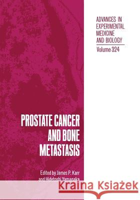 Prostate Cancer and Bone Metastasis James P. Karr Hidetoshi Yamanaka James P 9781461365013 Springer - książka