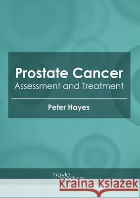 Prostate Cancer: Assessment and Treatment Peter Hayes 9781632418173 Hayle Medical - książka