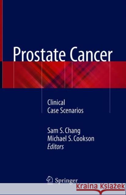 Prostate Cancer: Clinical Case Scenarios Chang, Sam S. 9783319786452 Springer - książka