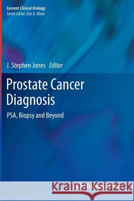 Prostate Cancer Diagnosis: Psa, Biopsy and Beyond Jones, J. Stephen 9781627031875  - książka