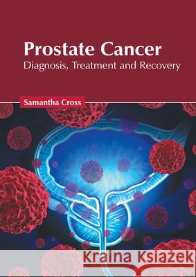 Prostate Cancer: Diagnosis, Treatment and Recovery Samantha Cross 9781632429209 Foster Academics - książka