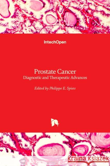 Prostate Cancer: Diagnostic and Therapeutic Advances Philippe E. Spiess 9789533073194 Intechopen - książka