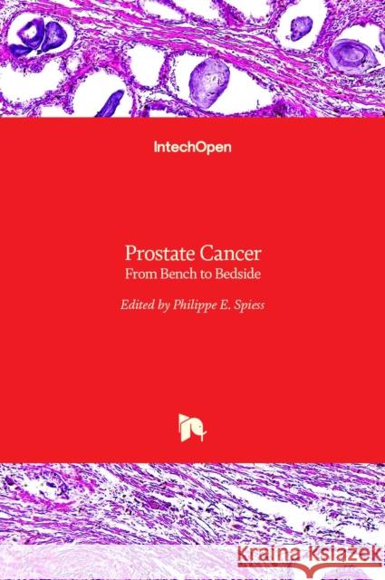 Prostate Cancer: From Bench to Bedside Philippe E. Spiess 9789533073316 Intechopen - książka