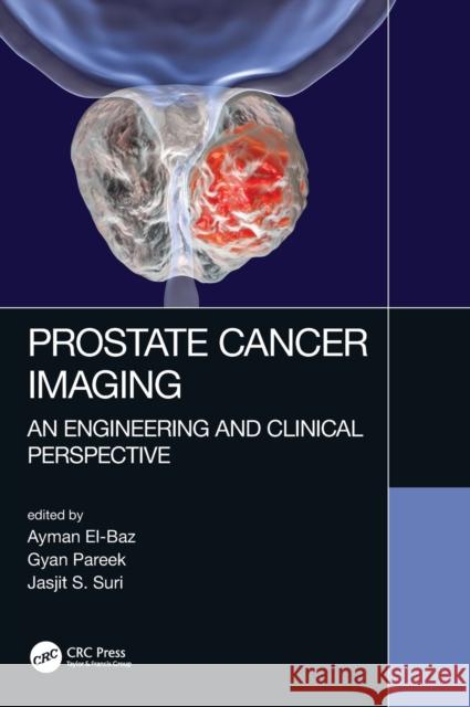 Prostate Cancer Imaging: An Engineering and Clinical Perspective Ayman El-Baz Gyan Pareek Jasjit S. Suri 9781498786232 CRC Press - książka