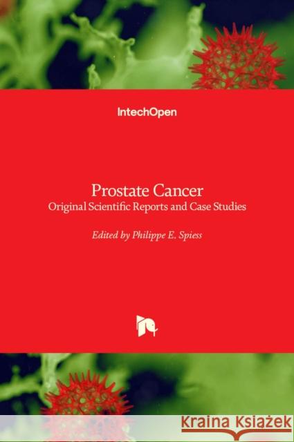 Prostate Cancer: Original Scientific Reports and Case Studies Philippe E. Spiess 9789533073422 Intechopen - książka