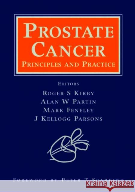 Prostate Cancer: Principles and Practice Kirby, Roger S. 9781841844589 Informa Healthcare - książka