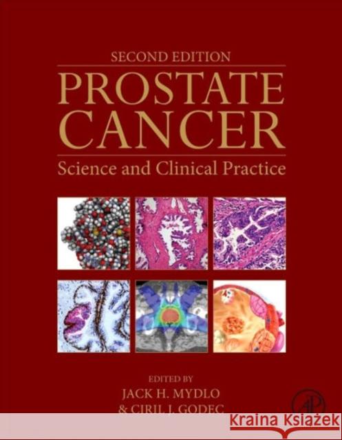 Prostate Cancer: Science and Clinical Practice Mydlo, Jack H. Godec, Ciril J.  9780128000779 Elsevier Science - książka