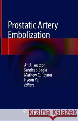 Prostatic Artery Embolization  9783030234706 Springer - książka