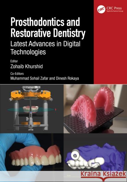 Prosthodontics and Restorative Dentistry: Latest Advances in Digital Technologies Zohaib Khurshid Muhammad Sohail Zafar Dinesh Rokaya 9781032550145 CRC Press - książka