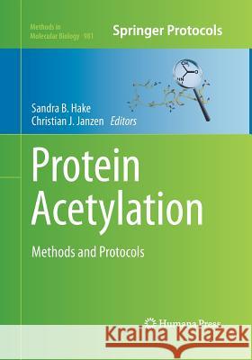Protein Acetylation: Methods and Protocols Hake, Sandra B. 9781493959488 Humana Press - książka