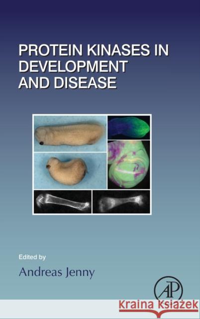 Protein Kinases in Development and Disease: Volume 123 Jenny, Andreas 9780128015131 Academic Press - książka