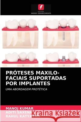 Próteses Maxilo-Faciais Suportadas Por Implantes Manoj Kumar, Aditi Saxena, Rahul Katyayan 9786203402520 Edicoes Nosso Conhecimento - książka